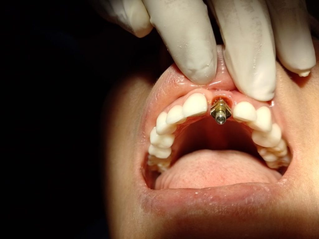 clínica odontológica en Medellín