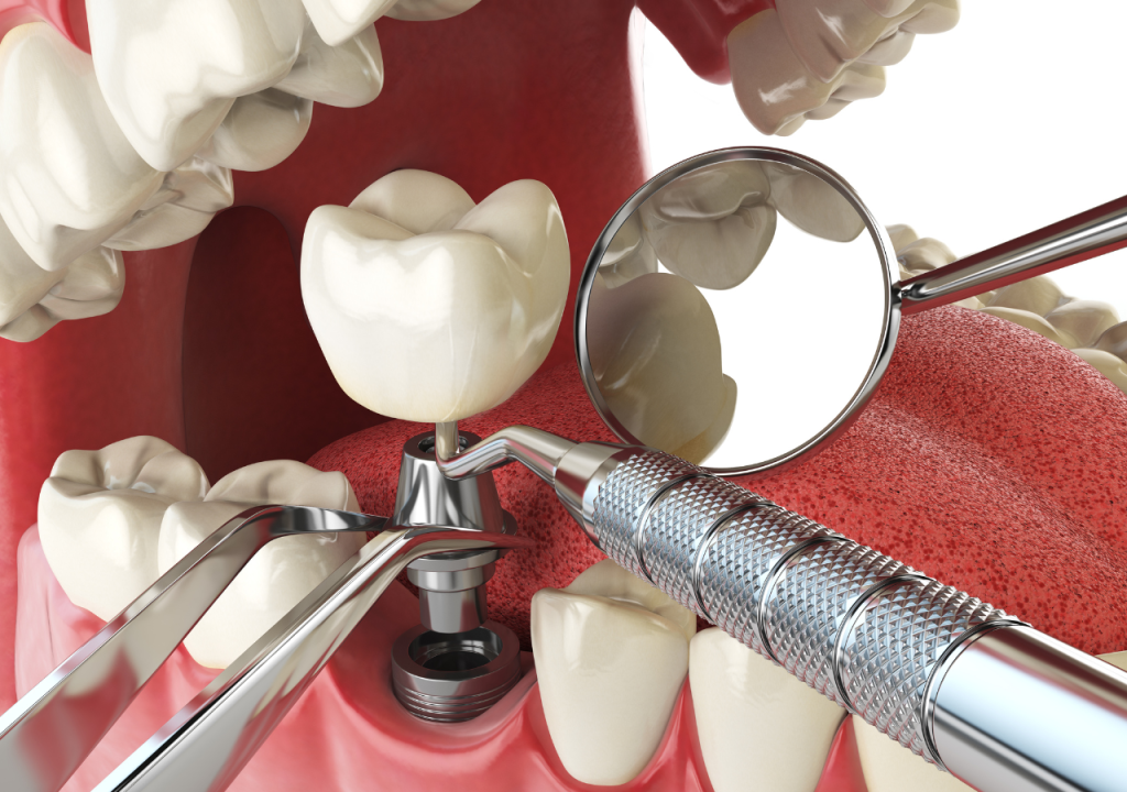 Turismo dental