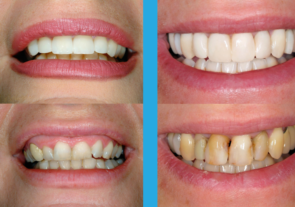 Turismo dental
