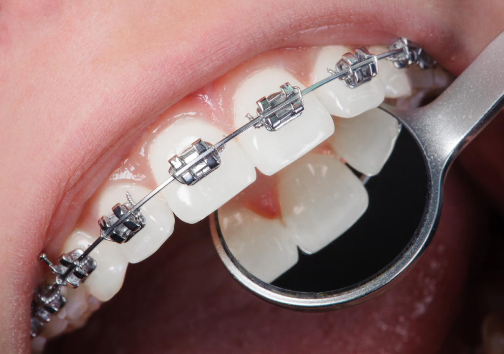 Turismo dental