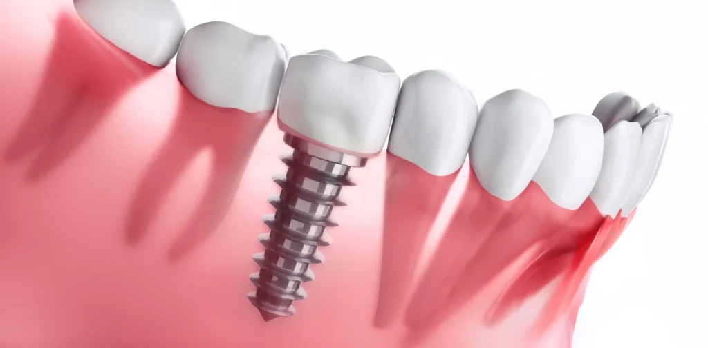 clínica dental Medellín
